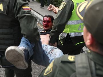 Un herido es socorrido por miembros de la Policía de Colombia Un herido es socorrido por miembros de la Policía de Colombia