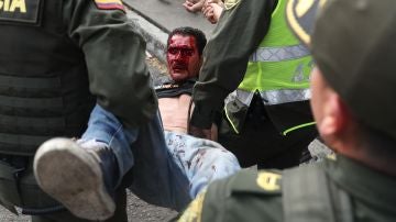 Un herido es socorrido por miembros de la Policía de Colombia 