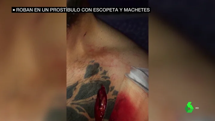 Varias personas atracan un prostíbulo con machetes y escopetas dejando herida a una persona en Otero, Toledo