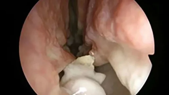 Imagen del extraño caso Imagen del extraño caso