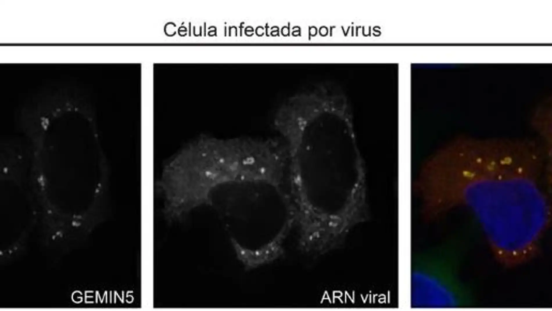 Descubren las proteinas de union al ARN que causan la infeccion por virus