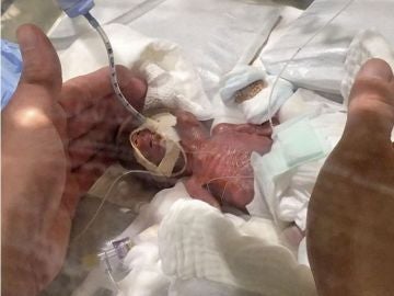 Imagen del bebé tras nacer Imagen del bebé tras nacer