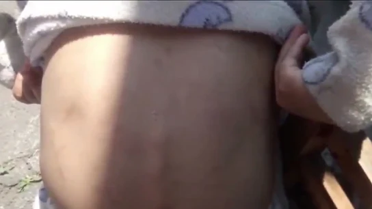 Imagen del niño rescatado en Tlalpan, México Imagen del niño rescatado en Tlalpan, México