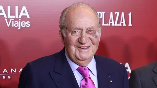 El Rey emérito Juan Carlos con el ojo morado El Rey emérito Juan Carlos con el ojo morado