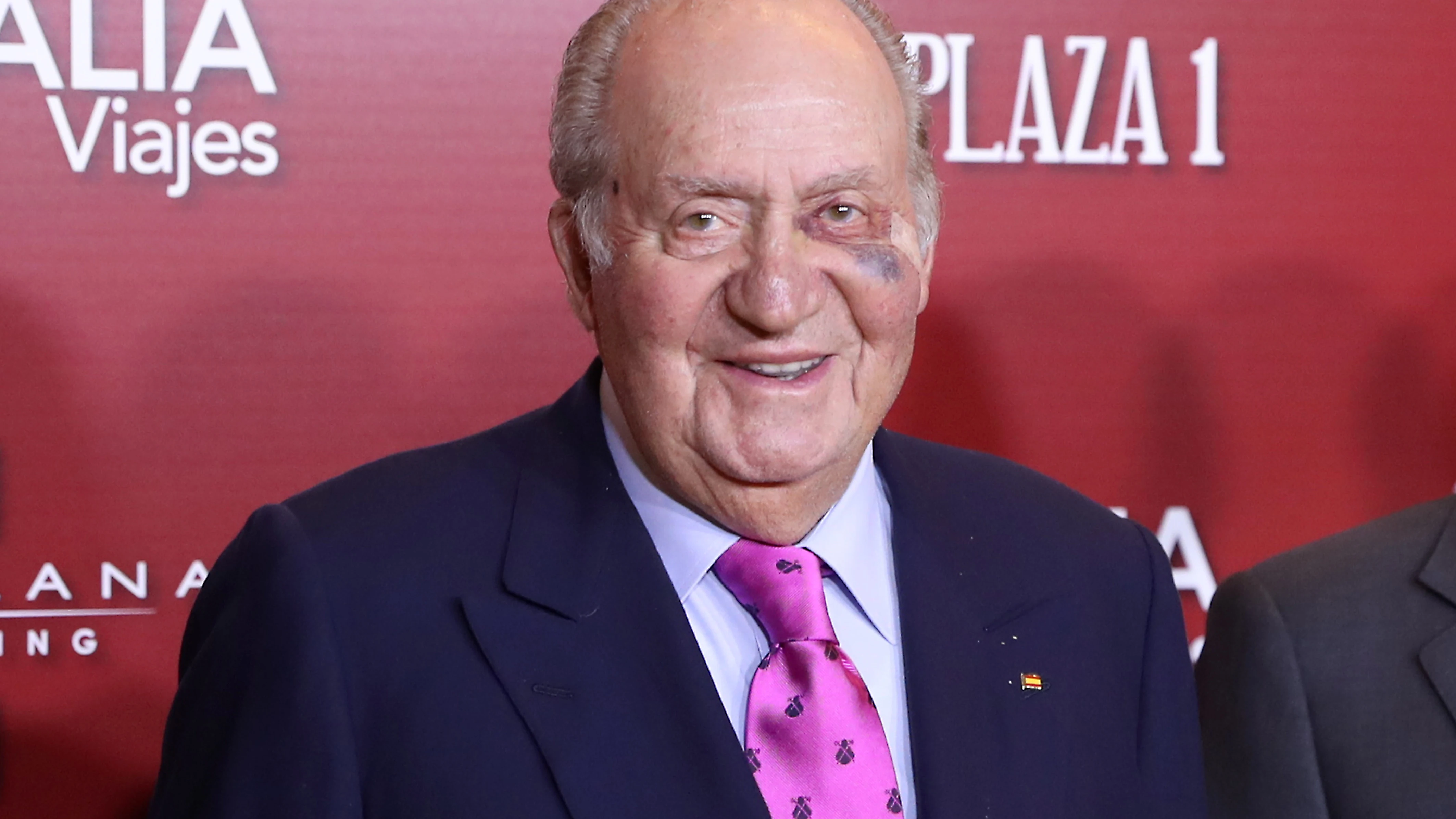 El Rey emérito Juan Carlos con el ojo morado