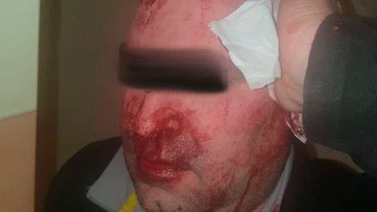 El vigilante agredido en un centro de menores en Hortaleza, Madrid El vigilante agredido en un centro de menores en Hortaleza, Madrid