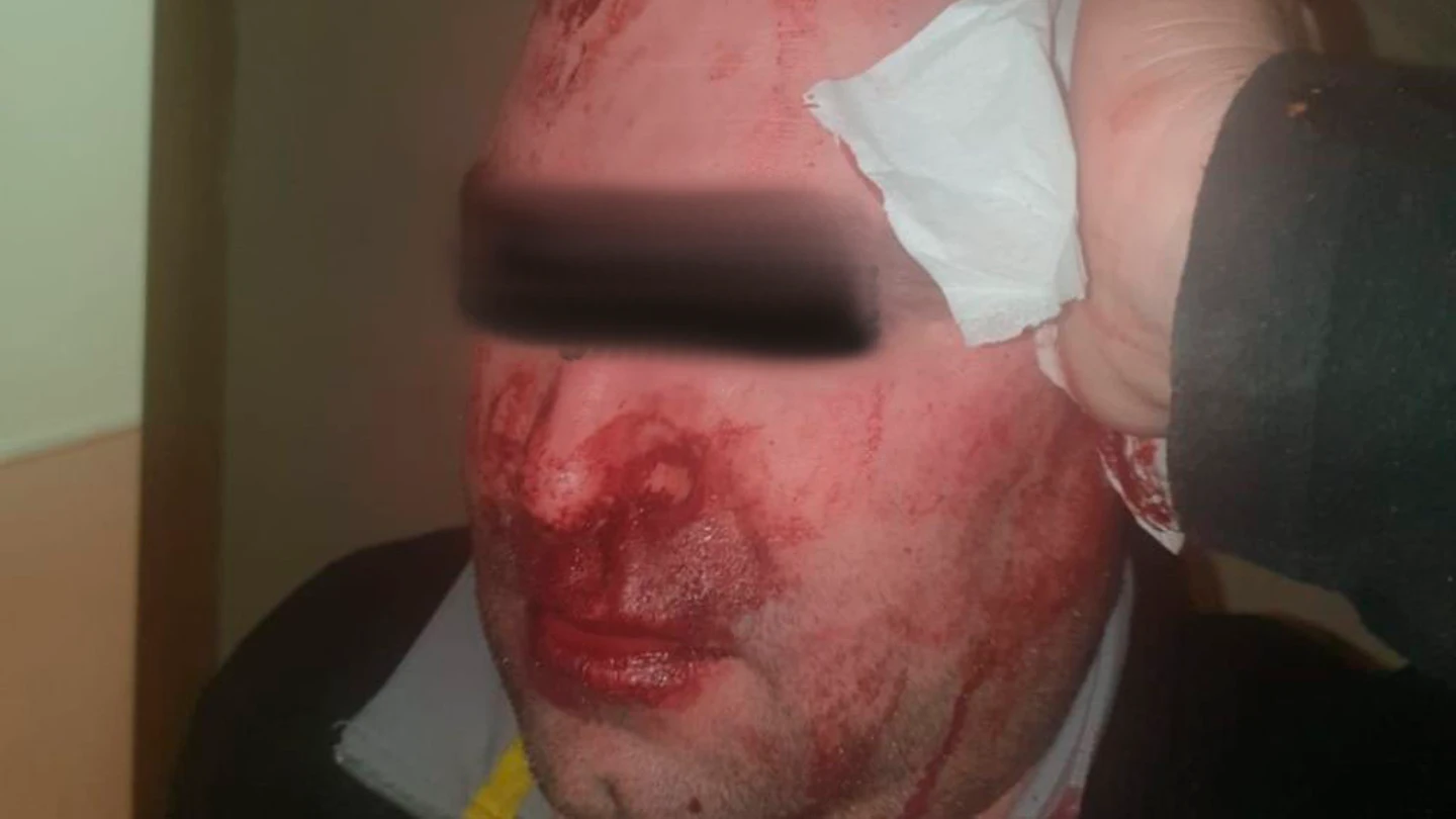 El vigilante agredido en un centro de menores en Hortaleza, Madrid El vigilante agredido en un centro de menores en Hortaleza, Madrid