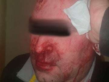 El vigilante agredido en un centro de menores en Hortaleza, Madrid El vigilante agredido en un centro de menores en Hortaleza, Madrid