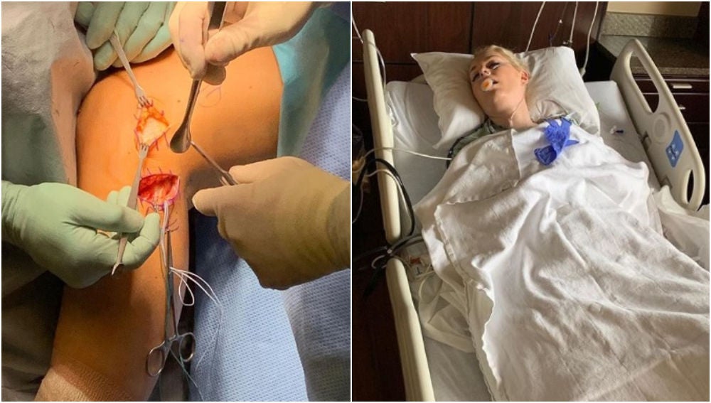 Imágenes de la operación de Lindsey Vonn