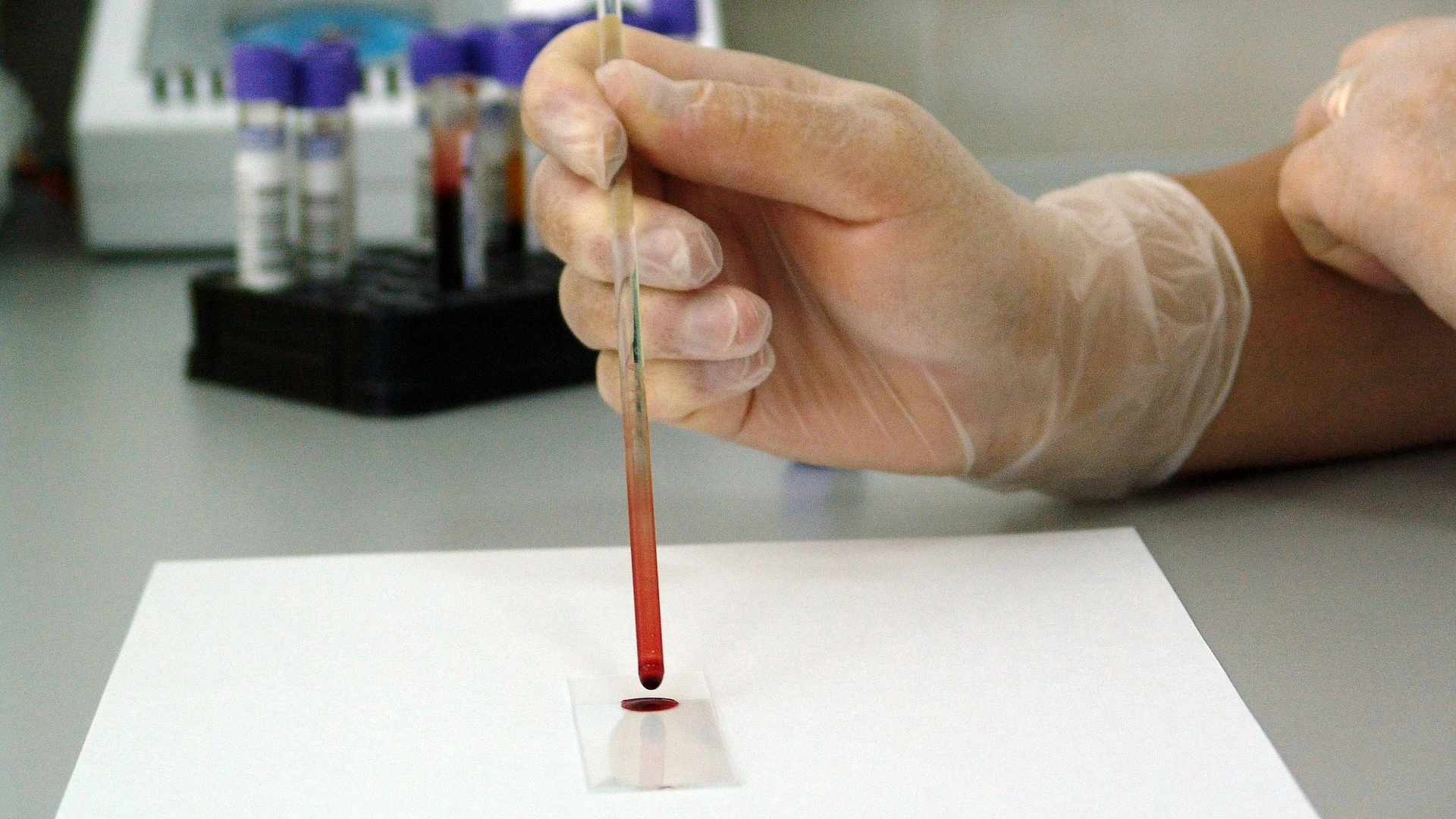 Análisis de una muestra de sangre en un laboratorio