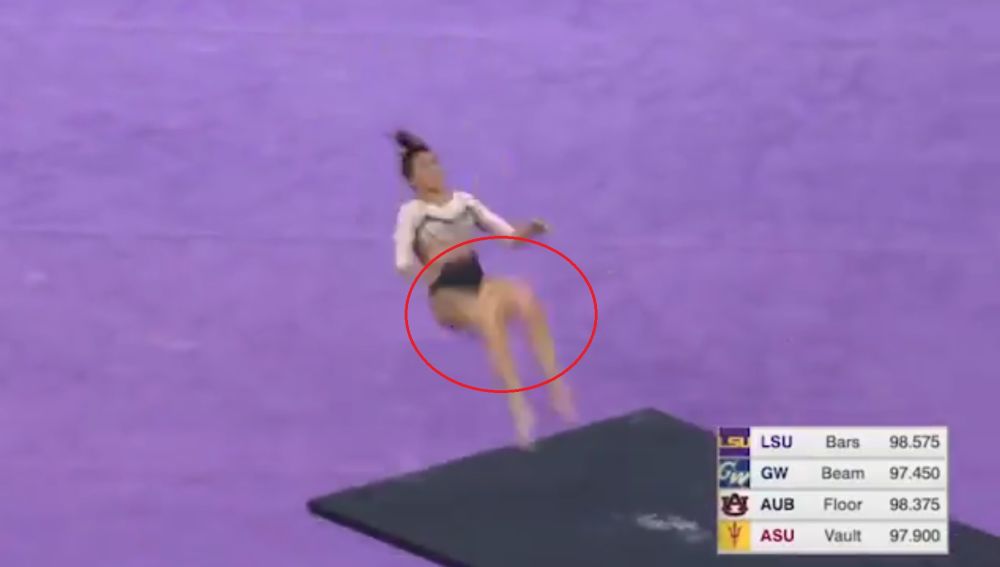 Una gimnasta se rompe las dos piernas en pleno ejercicio — Espeluznante Una gimnasta se rompe las dos piernas en pleno ejercicio — Espeluznante