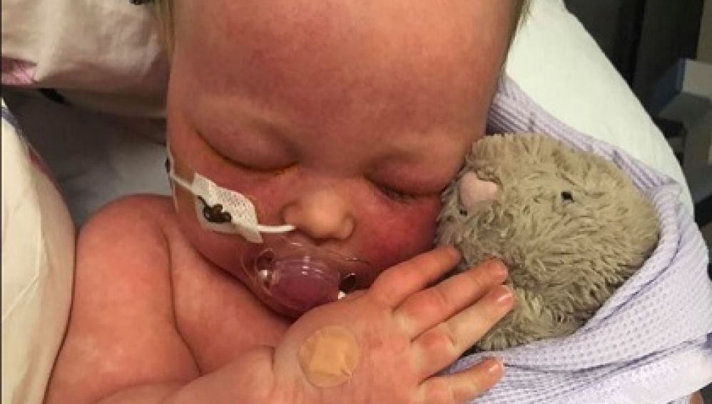 Una madre comparte fotos de su bebe con sarampión para concienciar a los 'antivacunas'