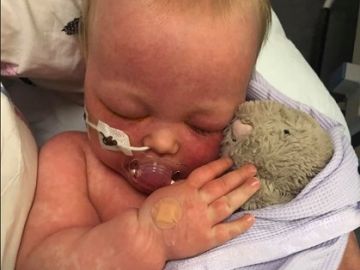 Una madre comparte fotos de su bebe con sarampión para concienciar a los 'antivacunas' Una madre comparte fotos de su bebe con sarampión para concienciar a los 'antivacunas'
