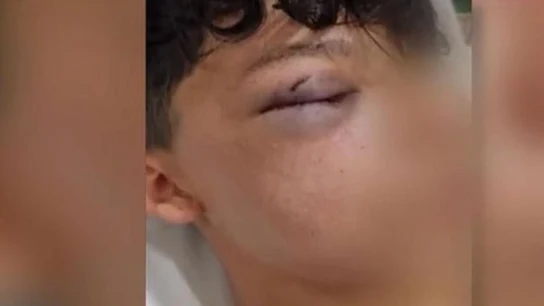 Brutal agresión a un menor en un barrio de Madrid Brutal agresión a un menor en un barrio de Madrid