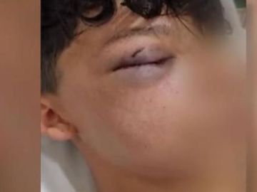 Brutal agresión a un menor en un barrio de Madrid Brutal agresión a un menor en un barrio de Madrid