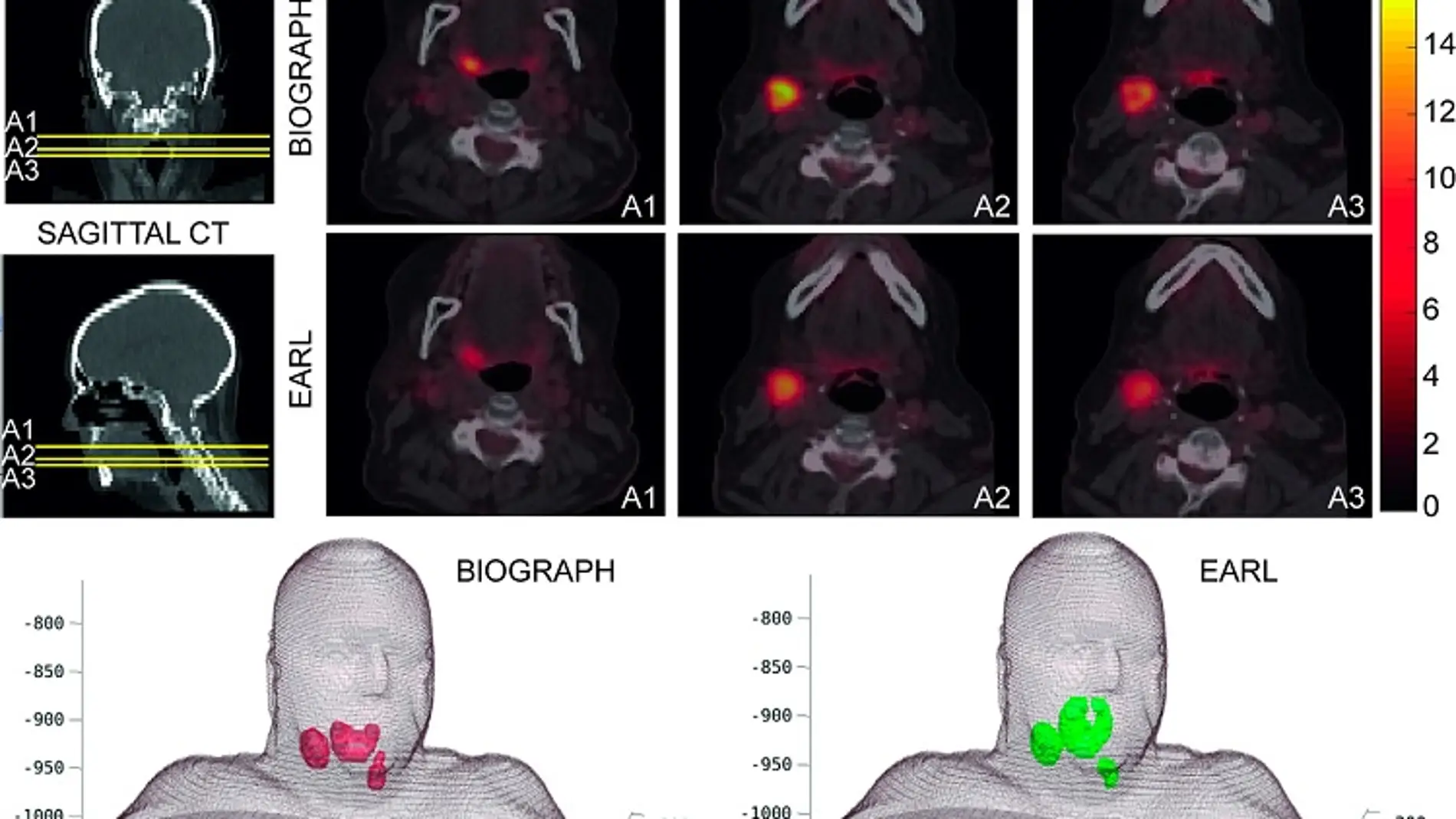 La radioterapia a medida mejorara los tratamientos contra el cancer