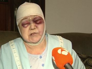 Propinan una brutal paliza a una anciana de 91 años en L'Hospitalet: "Me rajó la cabeza" Propinan una brutal paliza a una anciana de 91 años en L'Hospitalet: "Me rajó la cabeza"