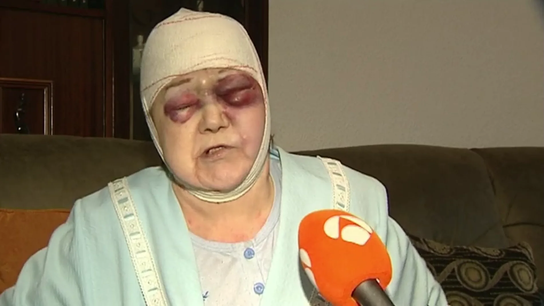 Propinan una brutal paliza a una anciana de 91 años en L'Hospitalet: "Me rajó la cabeza"