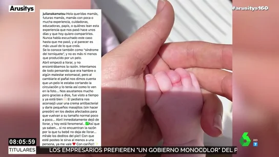 La hija recién nacida de Melendi y Julia Nakamatsu se recupera tras sufrir el síndrome del torniquete La hija recién nacida de Melendi y Julia Nakamatsu se recupera tras sufrir el síndrome del torniquete