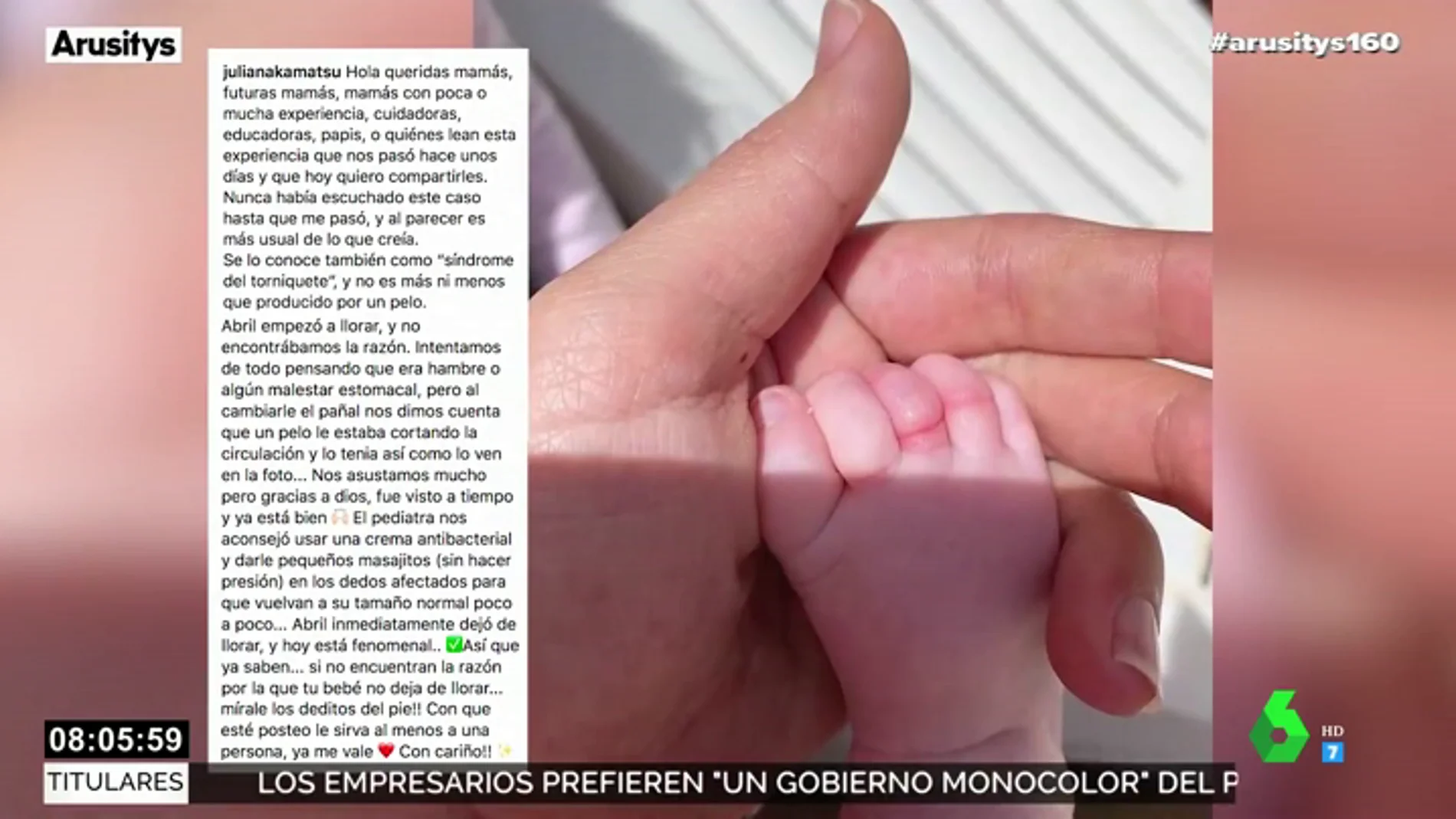 La hija recién nacida de Melendi y Julia Nakamatsu se recupera tras sufrir el síndrome del torniquete