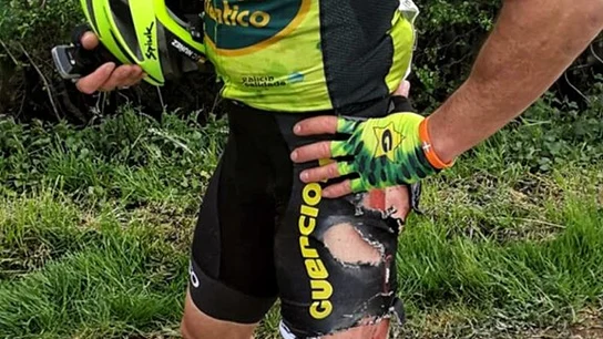 Las heridas de José Carlos Núñez tras ser atropellado Las heridas de José Carlos Núñez tras ser atropellado