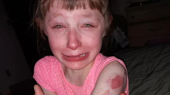 Imagen de la niña agredida Imagen de la niña agredida