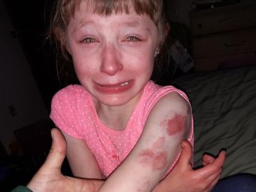 Imagen de la niña agredida Imagen de la niña agredida