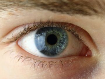 Imagen de archivo de un ojo. Imagen de archivo de un ojo.