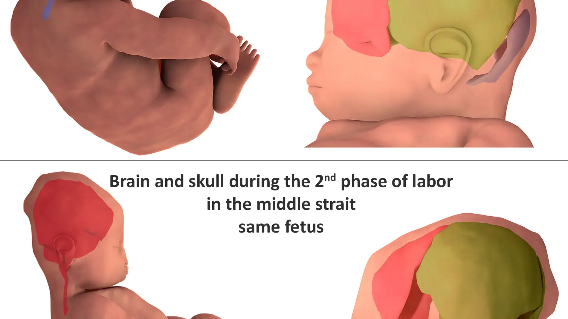 Asi se deforma la cabeza de los bebes para facilitar el parto
