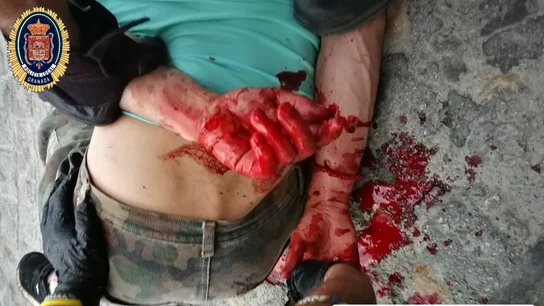 El agresor, con las manos ensangrentadas durante su detención El agresor, con las manos ensangrentadas durante su detención