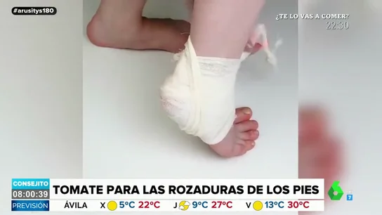 Curar las rozaduras con tomate y otros remedios caseros para aplicar a diario Curar las rozaduras con tomate y otros remedios caseros para aplicar a diario