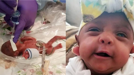 Saybie, la bebé más pequeña del mundo con vida Saybie, la bebé más pequeña del mundo con vida