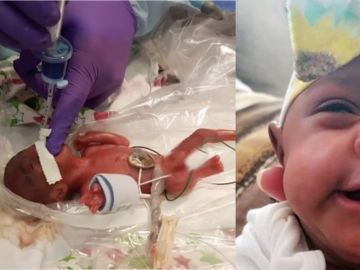 Saybie, la bebé más pequeña del mundo con vida Saybie, la bebé más pequeña del mundo con vida