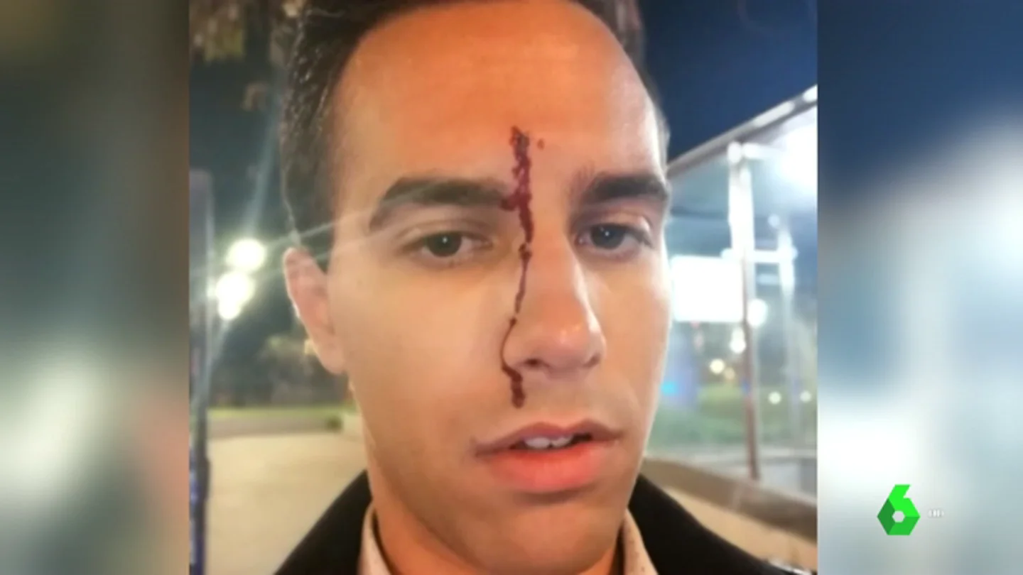 Dos jóvenes heridos después de sufrir un ataque homófobo en Barcelona Dos jóvenes heridos después de sufrir un ataque homófobo en Barcelona
