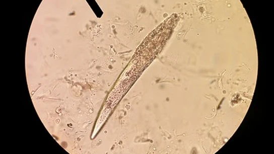 Imagen de un ácaro Demodex Imagen de un ácaro Demodex