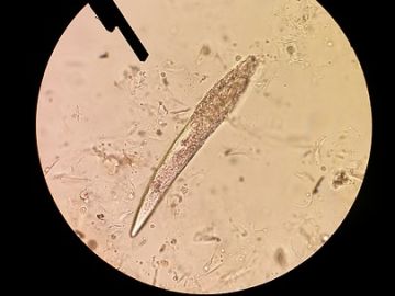 Imagen de un ácaro Demodex Imagen de un ácaro Demodex