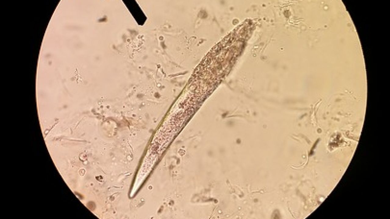 acaros en las pestañas microscopio