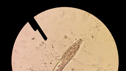 Imagen de un ácaro Demodex