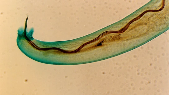 El angiostrongylus cantonensis, más conocido como un parásito que causa la enfermedad del gusano pulmonar de rata.  El angiostrongylus cantonensis, más conocido como un parásito que causa la enfermedad del gusano pulmonar de rata.