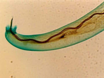 El angiostrongylus cantonensis, más conocido como un parásito que causa la enfermedad del gusano pulmonar de rata. El angiostrongylus cantonensis, más conocido como un parásito que causa la enfermedad del gusano pulmonar de rata.