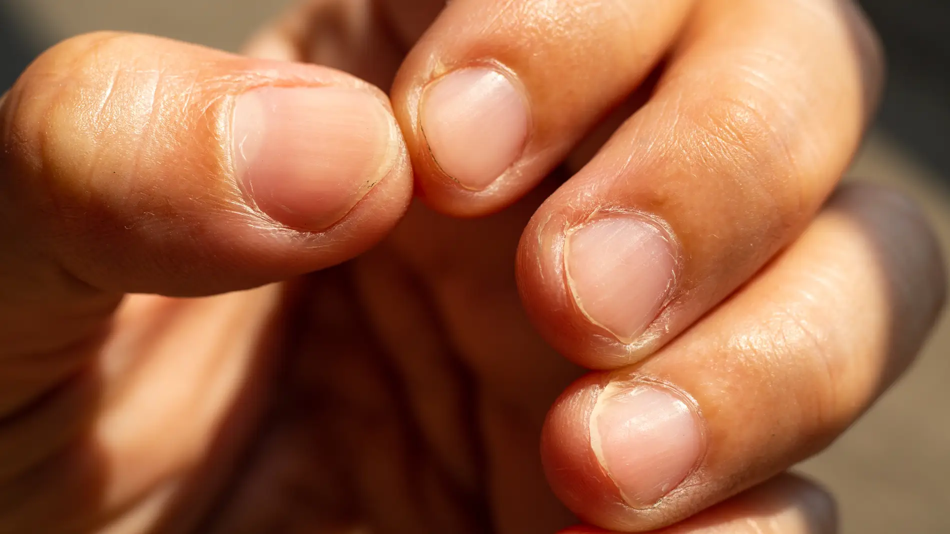 Morderte las uñas puede poner en peligro tu salud