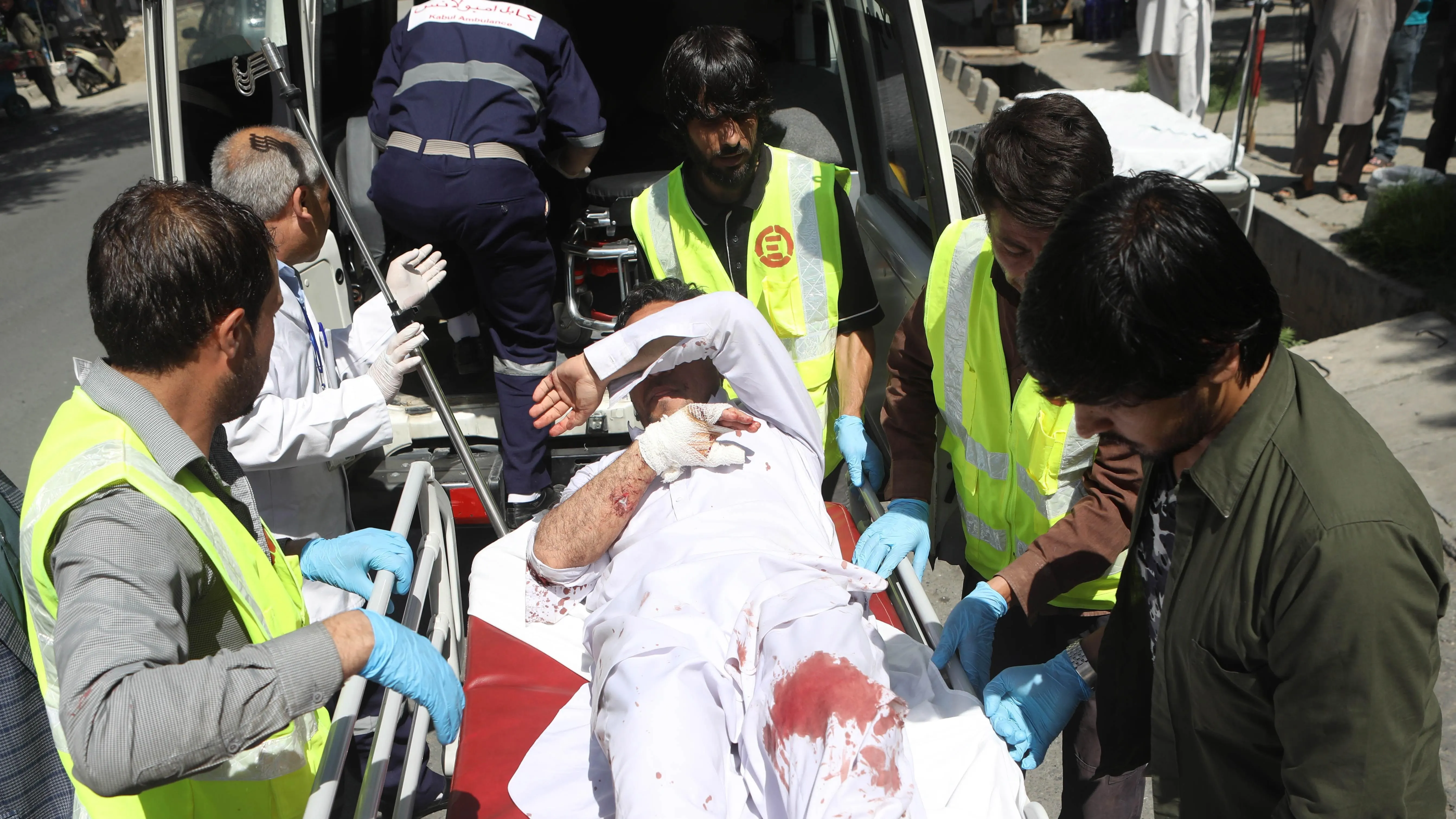 Un herido es trasladado a un hospital tras una explosión en Kabul, Afganistán