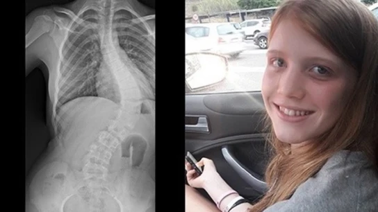 Una madre lanza un 'crowdfunding' para recaudar dinero para la operación de su hija Una madre lanza un 'crowdfunding' para recaudar dinero para la operación de su hija.