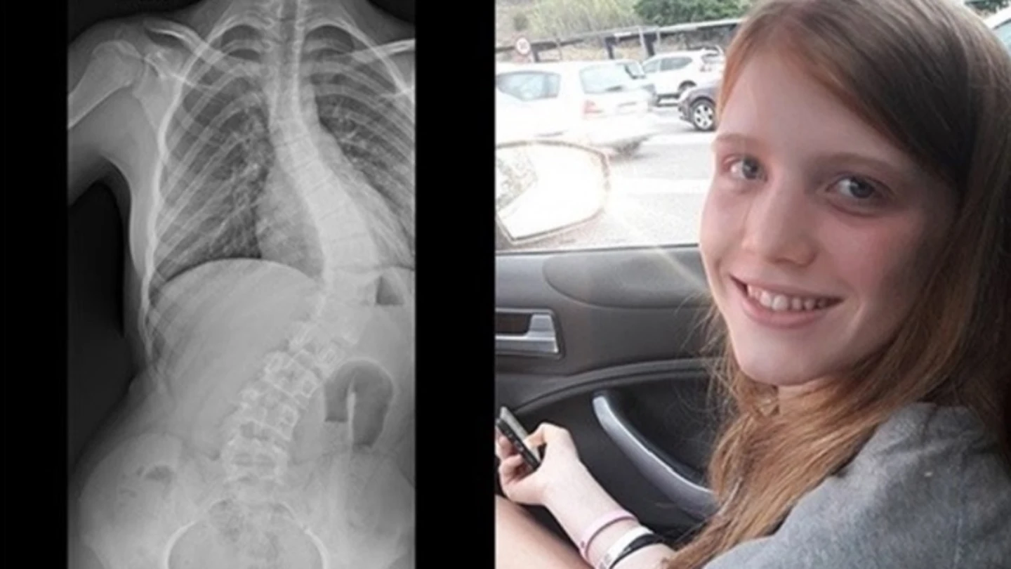 Una madre lanza un 'crowdfunding' para recaudar dinero para la operación de su hija Una madre lanza un 'crowdfunding' para recaudar dinero para la operación de su hija.