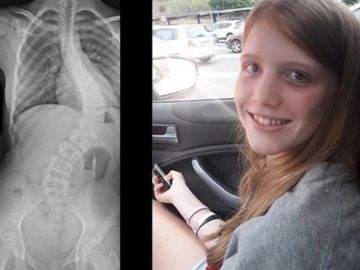 Una madre lanza un 'crowdfunding' para recaudar dinero para la operación de su hija Una madre lanza un 'crowdfunding' para recaudar dinero para la operación de su hija