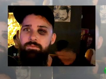 Agresión homófoba en el Metro de Barcelona: golpean a un joven por ser "demasiado gay" Agresión homófoba en el Metro de Barcelona: golpean a un joven por ser "demasiado gay"