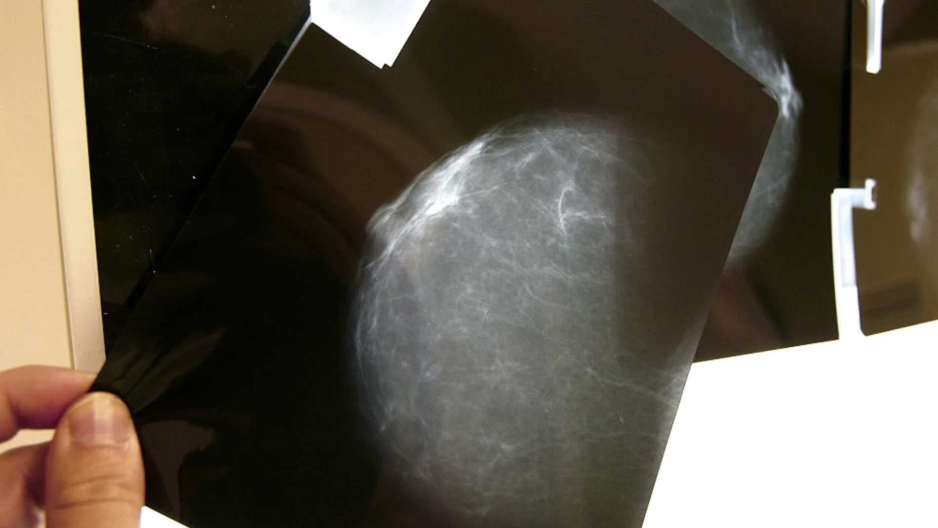 Una prueba radiológica de mama