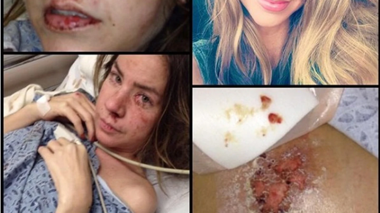 Jessica Landon en 2014 cuando bebía vodka 24 horas cada día Jessica Landon en 2014 cuando bebía vodka 24 horas cada día