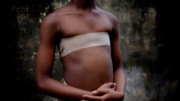 Una niña víctima del planchado de senos