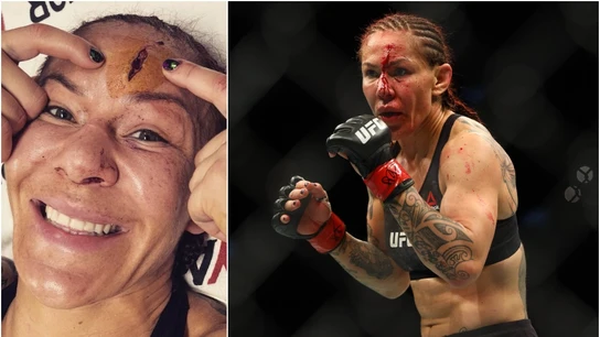 La aparatosa lesión de una luchadora de la UFC La aparatosa lesión de una luchadora de la UFC